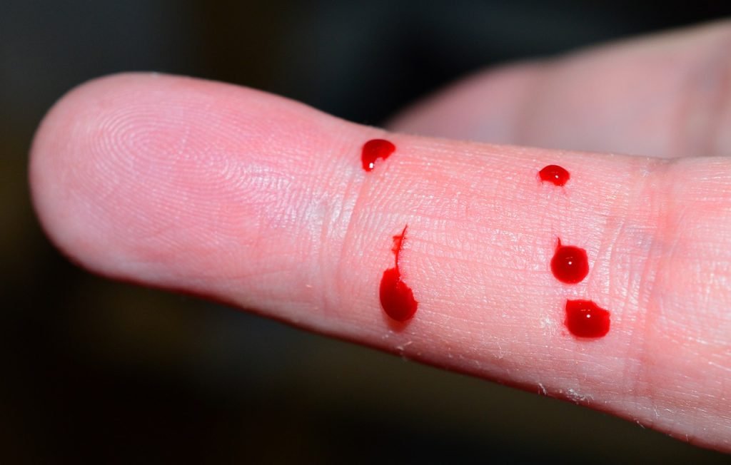 Cómo-Quitar-Manchas-de-Sangre