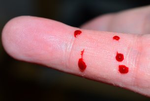 Cómo-Quitar-Manchas-de-Sangre